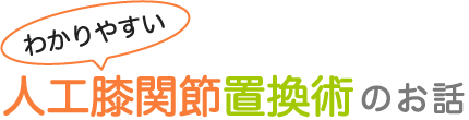 わかりやすい人工膝関節置換術のお話