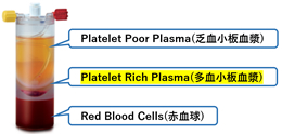 PRP(Platelet Rich Plasma)療法