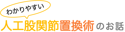 わかりやすい人工股関節置換術のお話